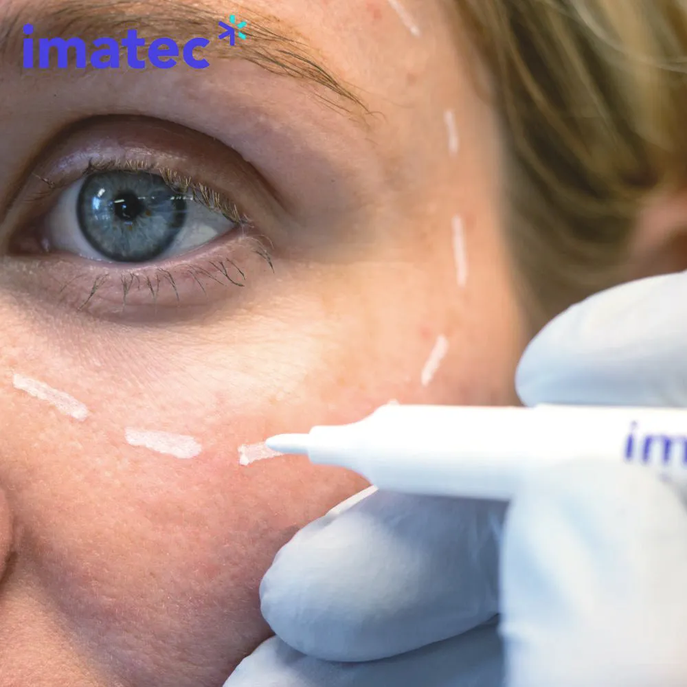 Marktec Skin Markers By Imatec Medical (White) - 10 Pack